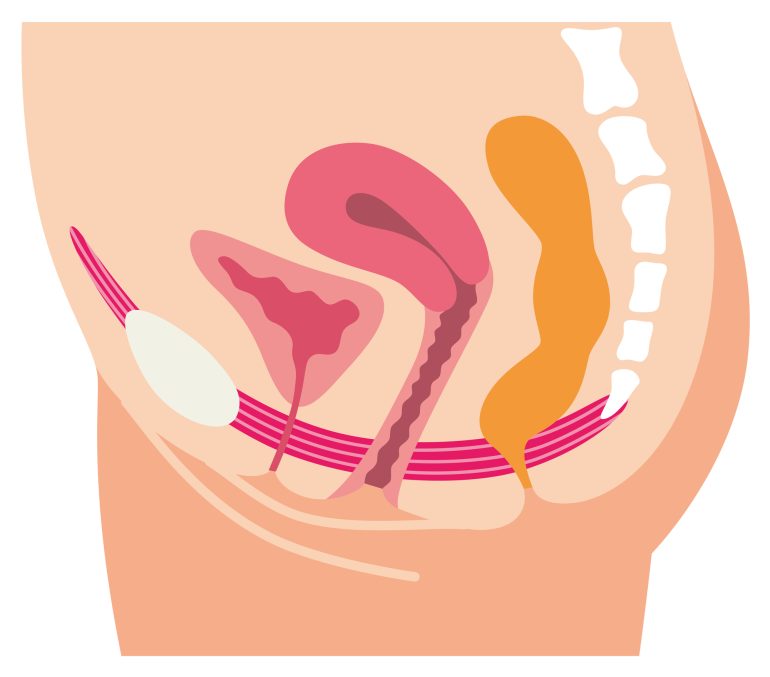 骨盤臓器脱(膀胱脱、子宮脱、直腸脱)について